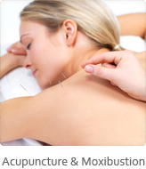 acupuncture